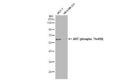 Western Blot: AKT [p Thr450] Antibody [NBP3-13168]